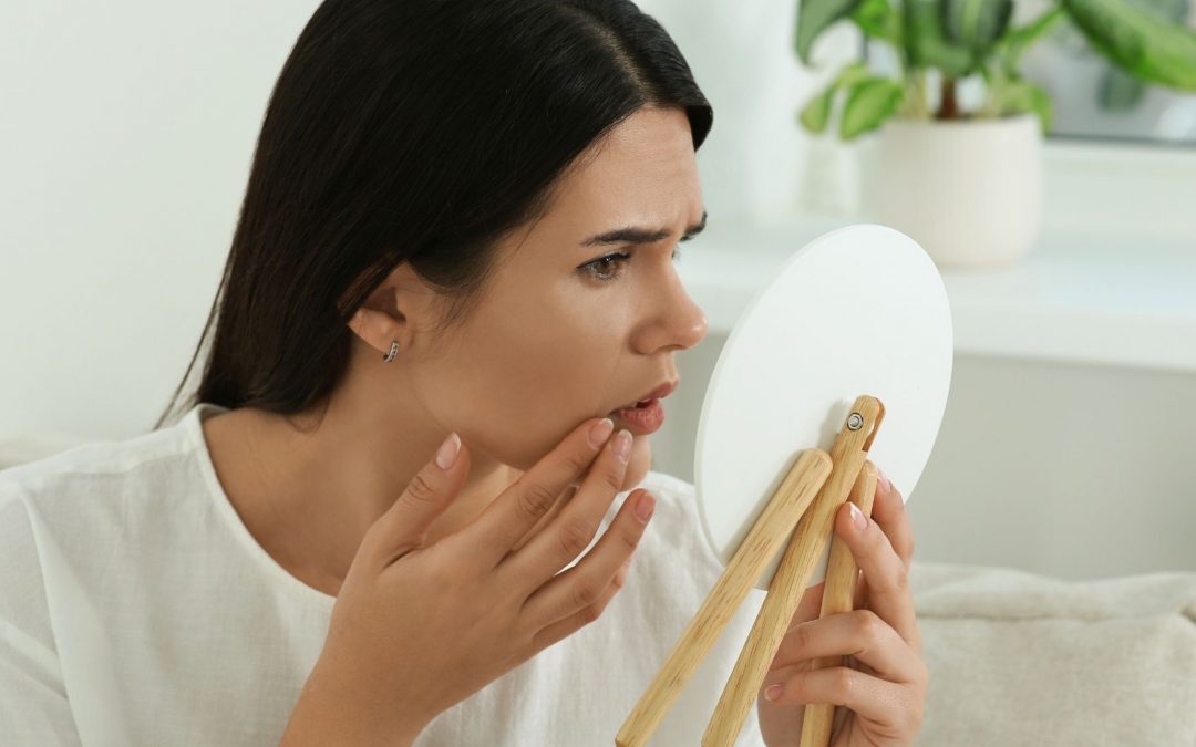 Différence entre l’acné hormonale et les autres types d’acné