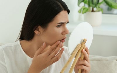 Différence entre l’acné hormonale et les autres types d’acné
