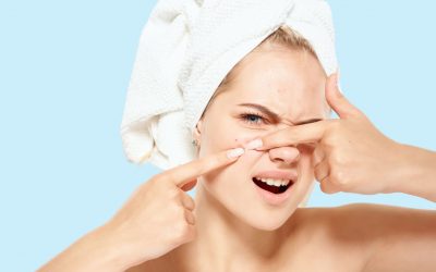 Est-il mauvais de percer un bouton blanc ?