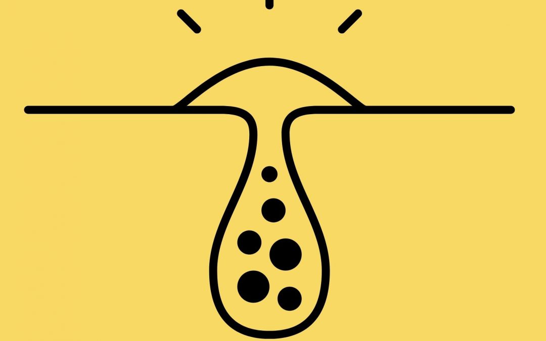 Les fluctuations hormonales influencent les glandes sébacées ?