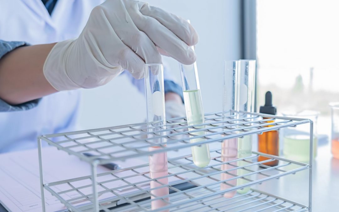 Acné et déséquilibres hormonaux : quels tests demander à son médecin