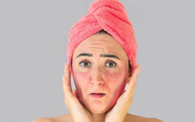 Comment calmer une peau irritée après un peeling