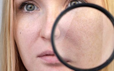 L’importance de l’hydratation pour les pores dilatés