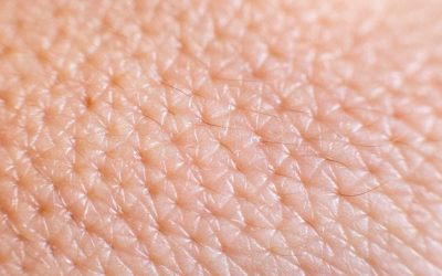 Le rôle des pores dilatés dans la formation des points noirs